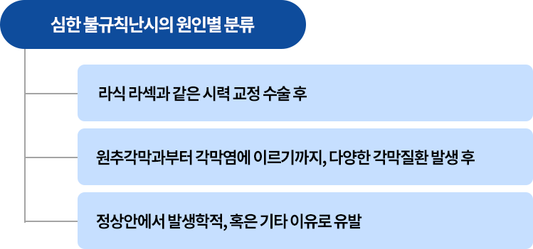 원추각막