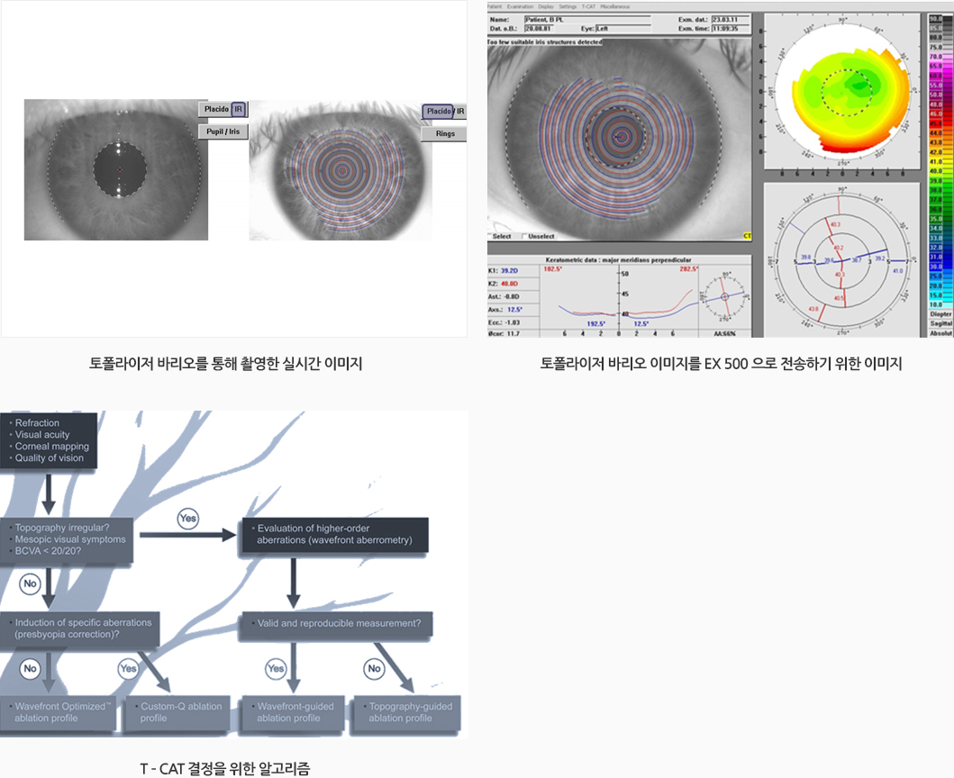 토폴라이저 바리오를 통해 촬영한 실시간 이미지 / 토폴라이저 바리오 이미지를 EX 500 으로 전송하기 위한 이미지 / T – CAT 결정을 위한 알고리즘