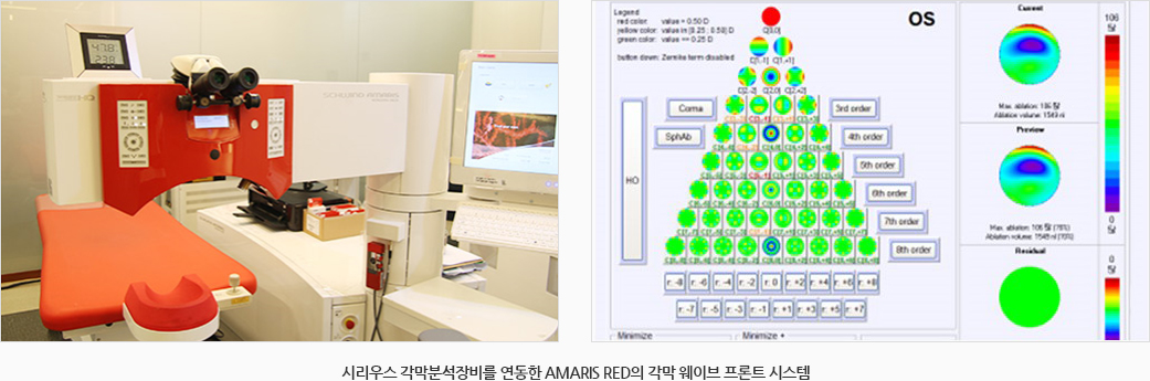 시리우스 각막분석장비를 연동한 AMARIS RED의 각막 웨이브 프론트 시스템