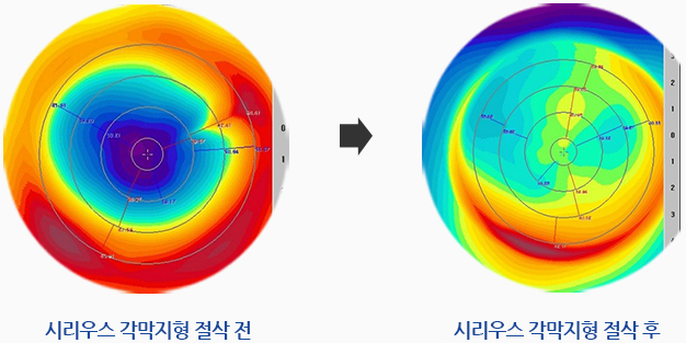 시리우스 이미지