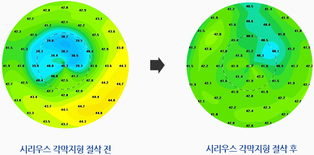 시리우스 이미지