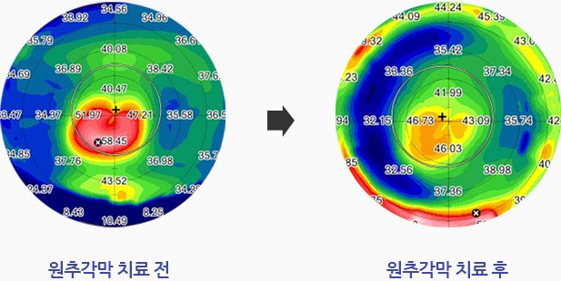 관련내용 이미지