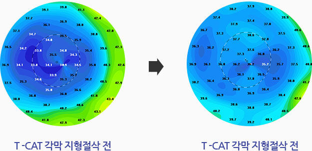 관련내용 이미지